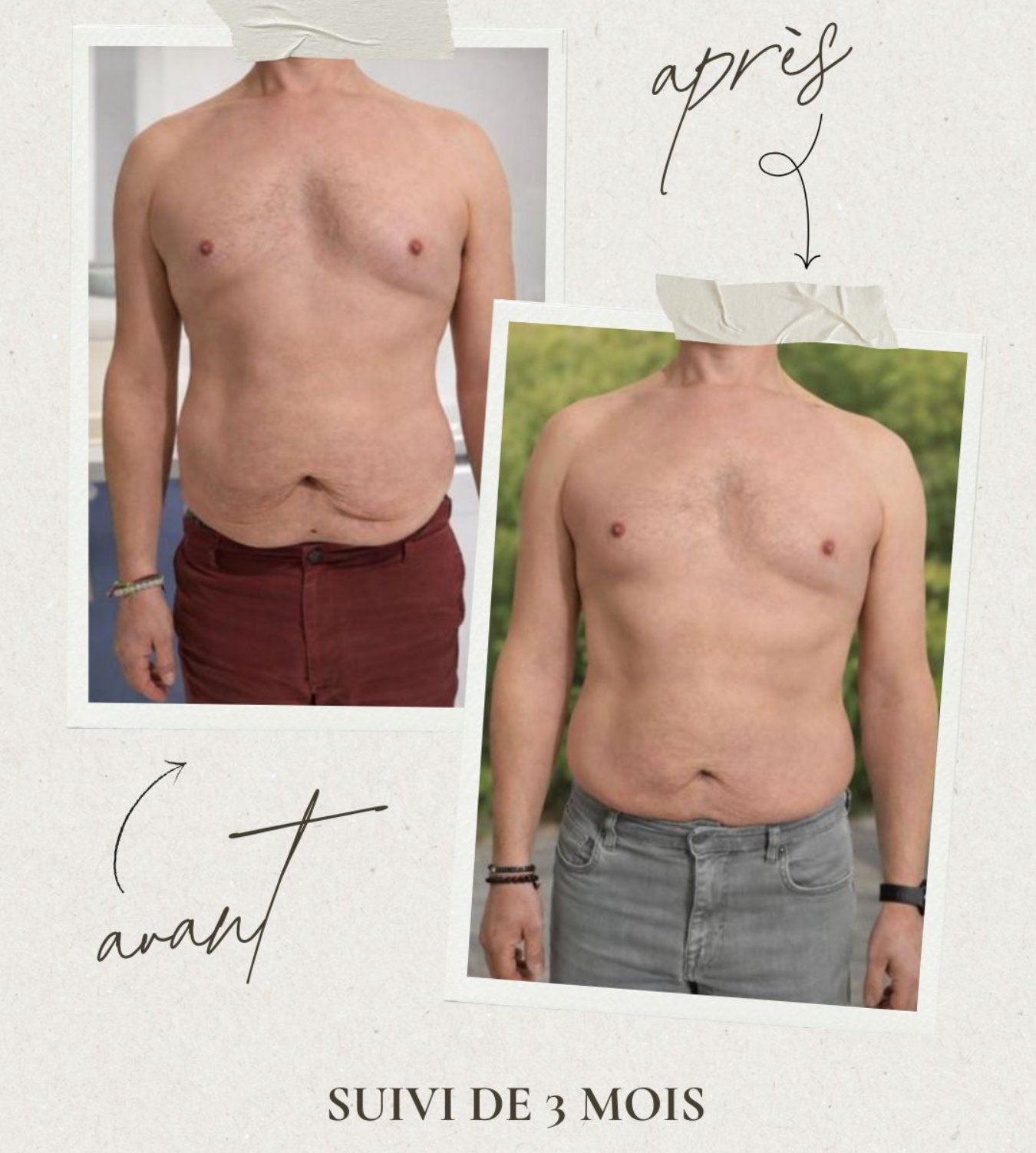 Comparaison côte à côte du torse d'un homme avant et après une période de 3 mois.