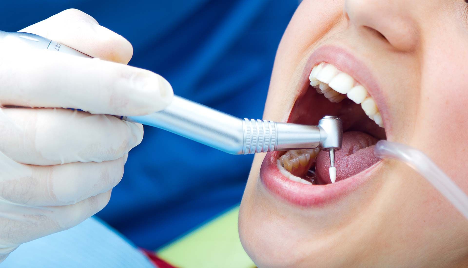 Odontólogo examinando la boca de un paciente con un espejo dental y la mano enguantada.