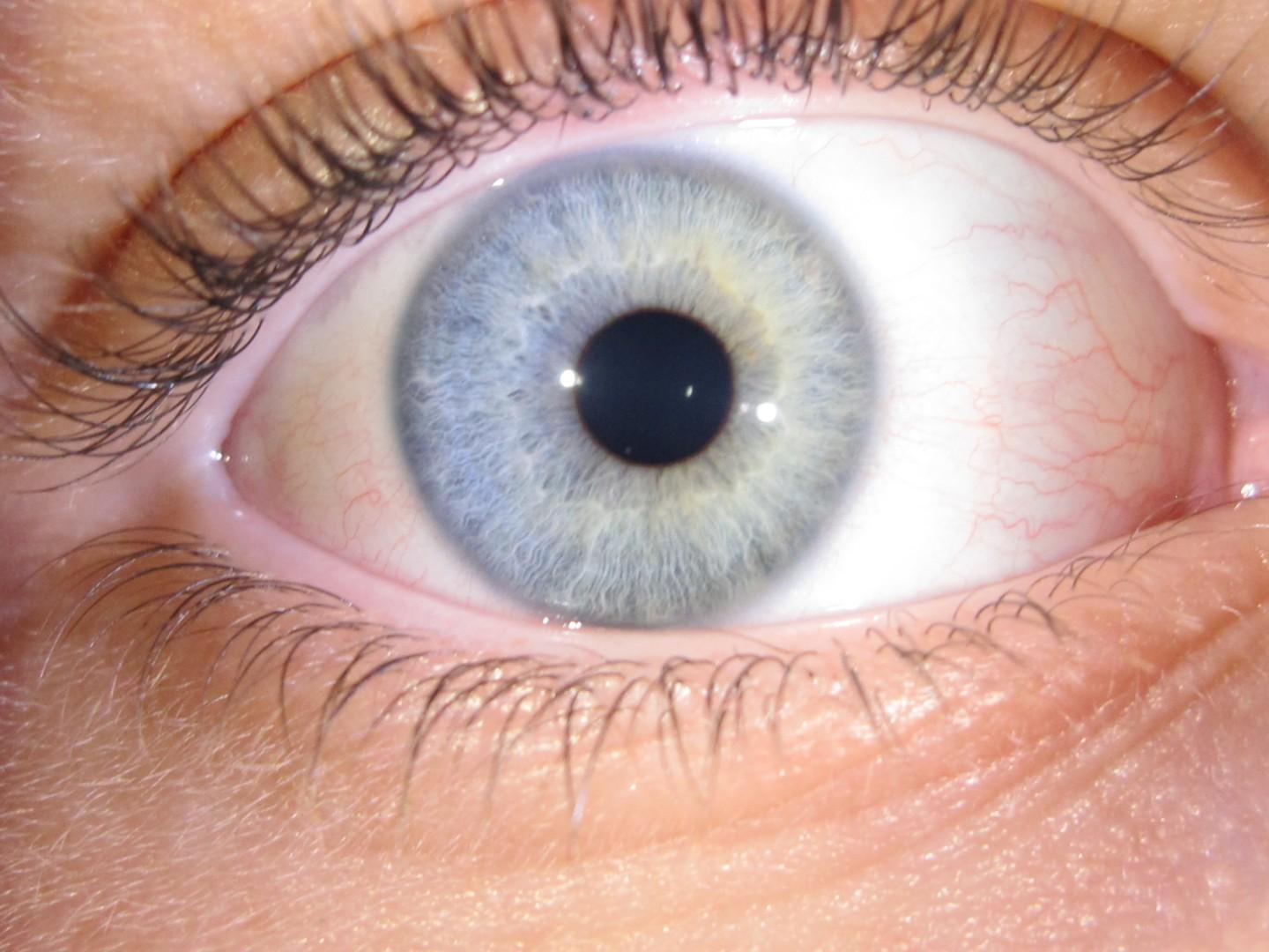 Edwige Flament - Naturopathe iridilogue - prise de photo pour le bilan iridologique