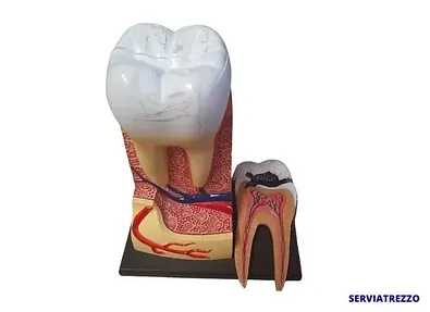 Un modelo de un diente con un agujero en él.