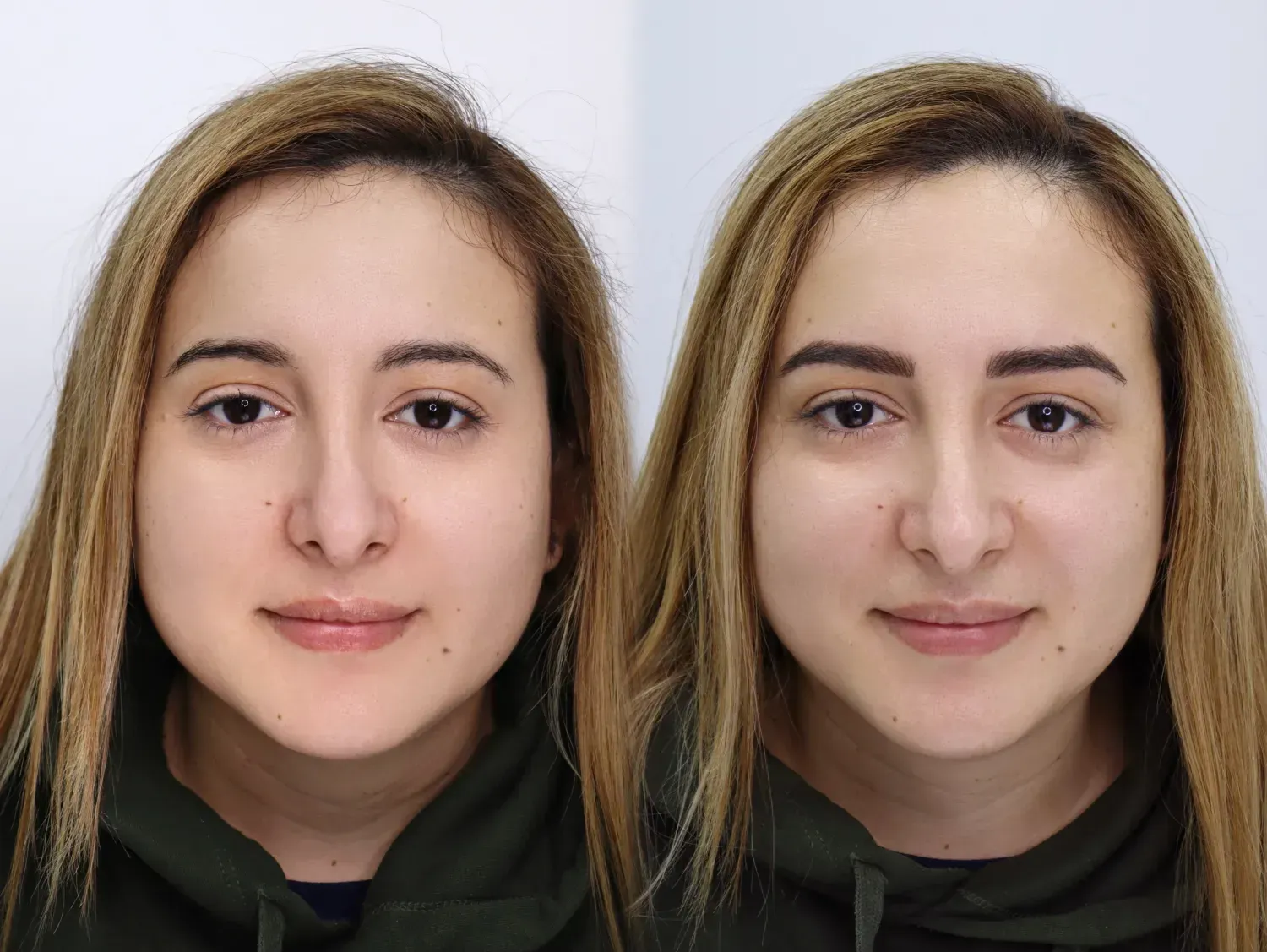 Primer plano de una persona antes y después.