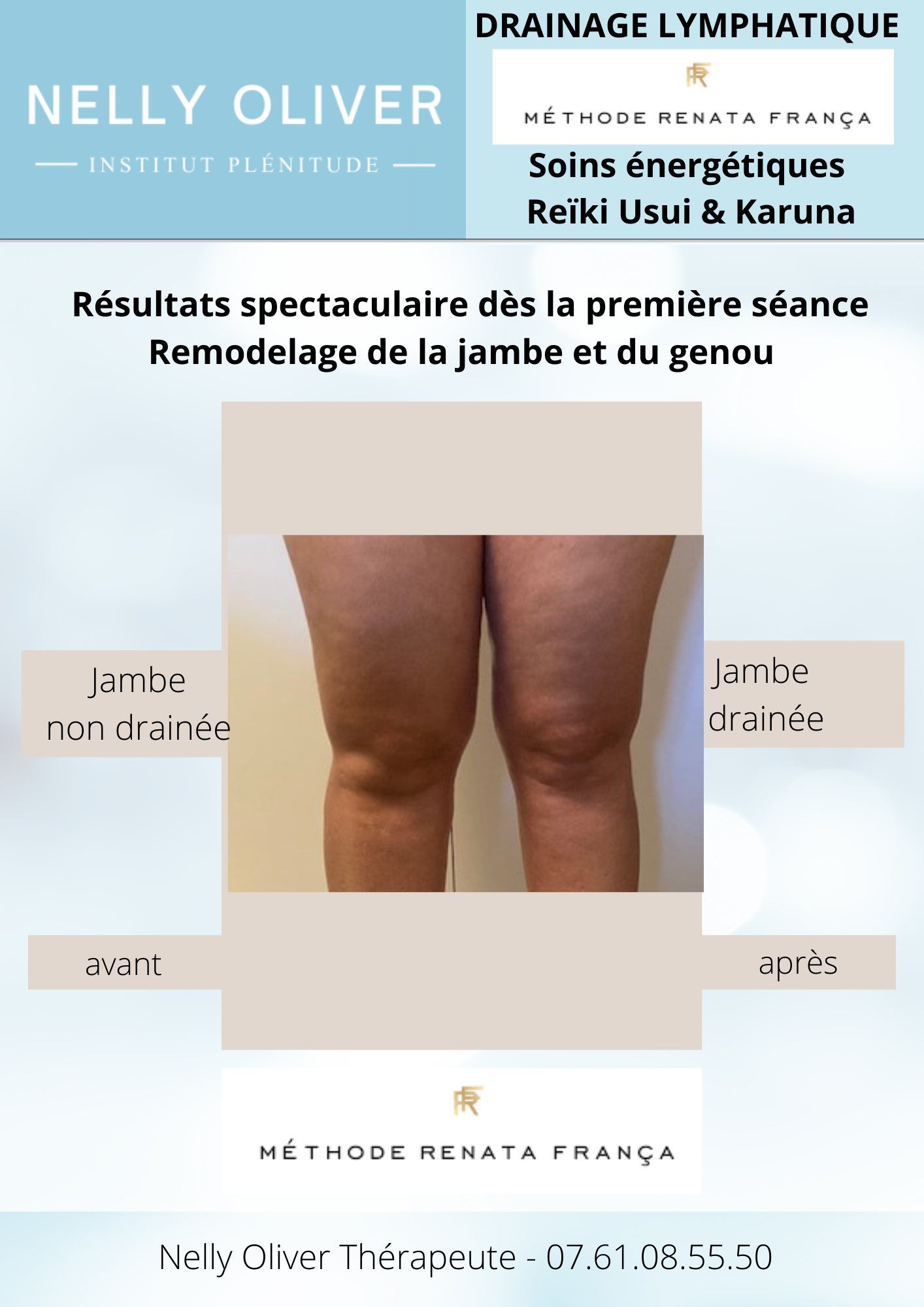 Comparatif jambe drainée