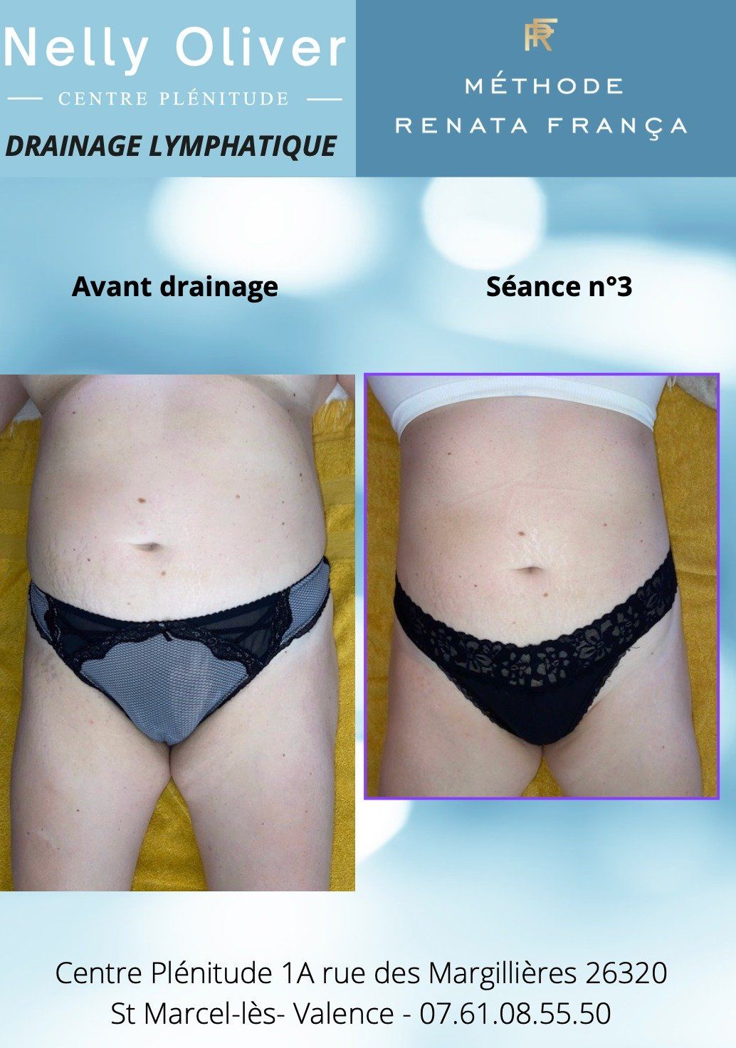 Avant-après ventre face