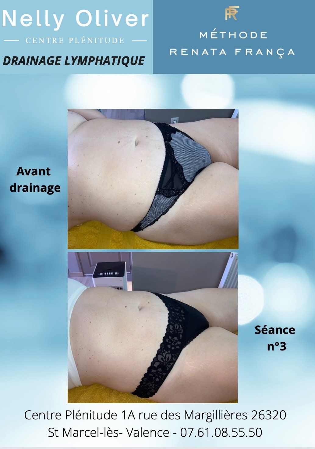 Avant-après ventre 3/4