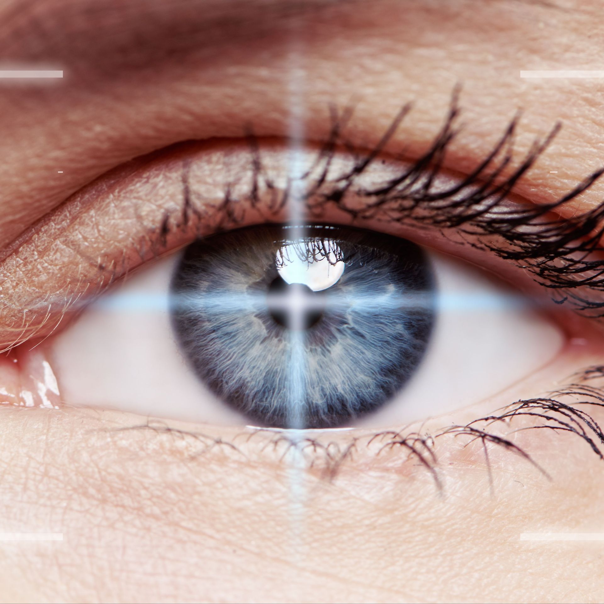 Augenarztpraxis am See AG - Laserbehandlung