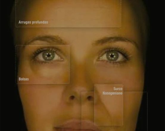 Un primer plano del rostro de una mujer con diferentes áreas etiquetadas.