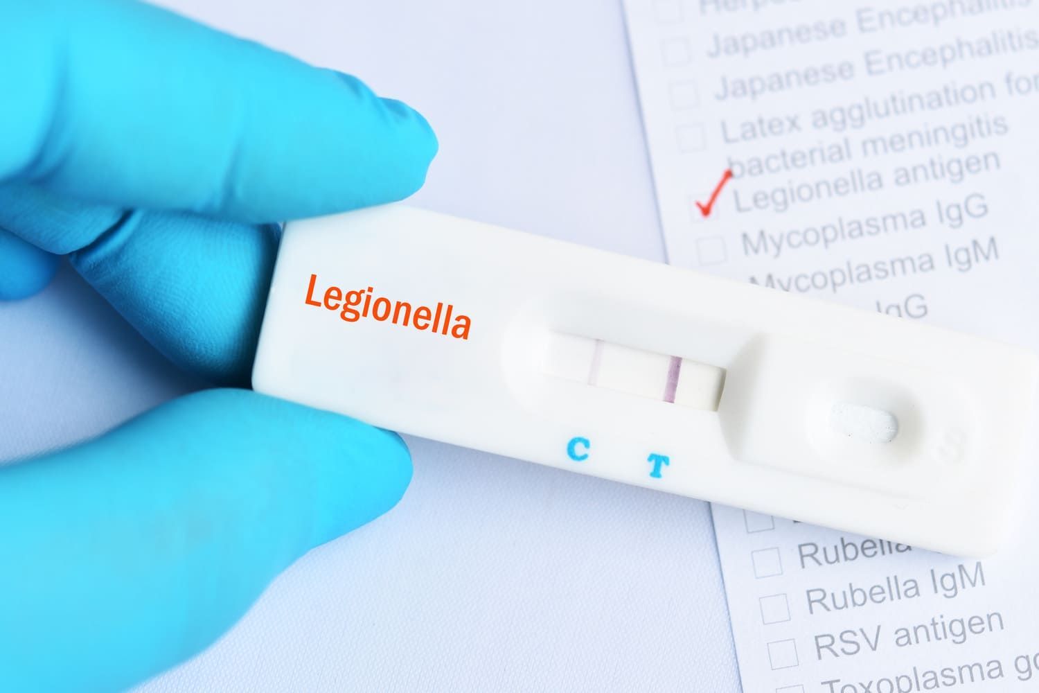 Una persona con guantes azules realiza una prueba de legionela.