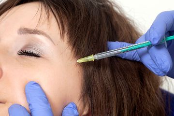 praxis steins, botox