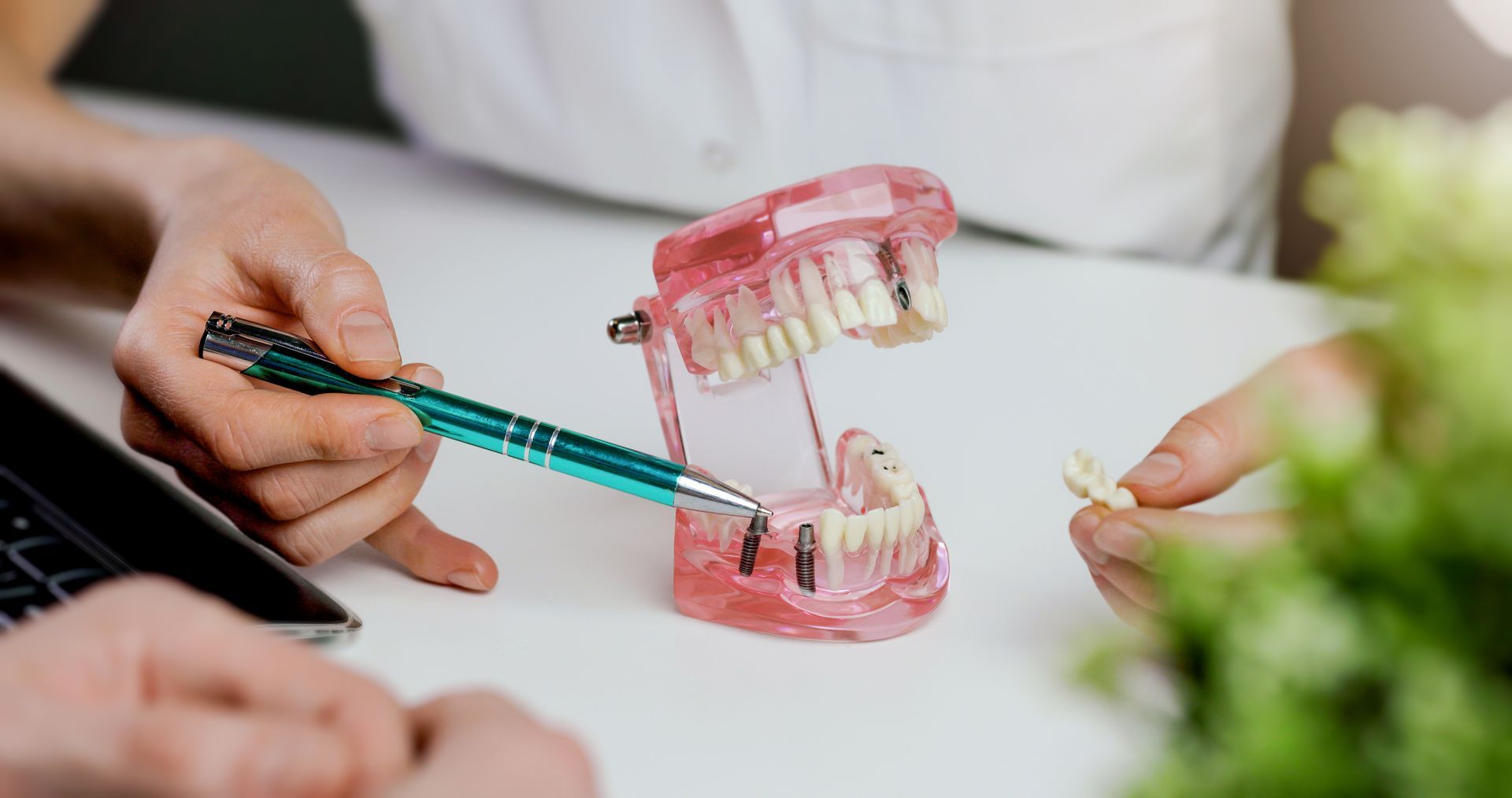 Hände demonstrieren die Zahnpflege an einem rosa Zahnmodell mit Zahnbürste und zahnärztlichem Instrument