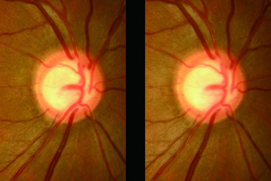 Augenheilkunde und Neurologie in Sargans