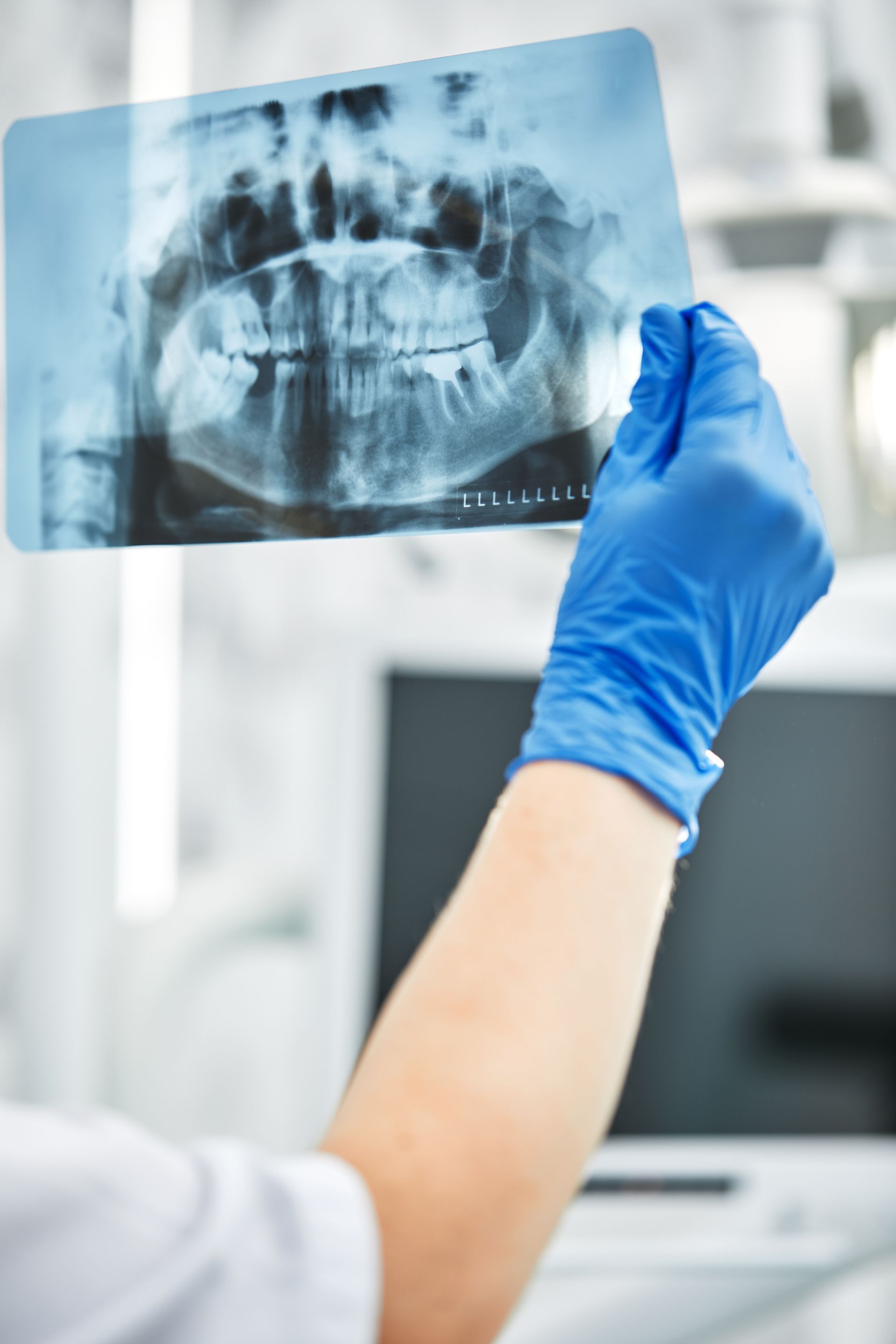 Un médecin qui consulte une radiologie panoramique dentaire