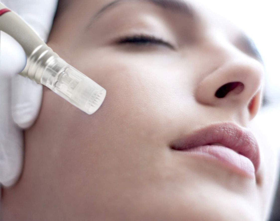Permanent Make-up + Microneedling