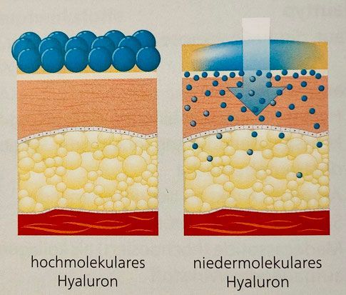 Permanent Make-up + Microneedling