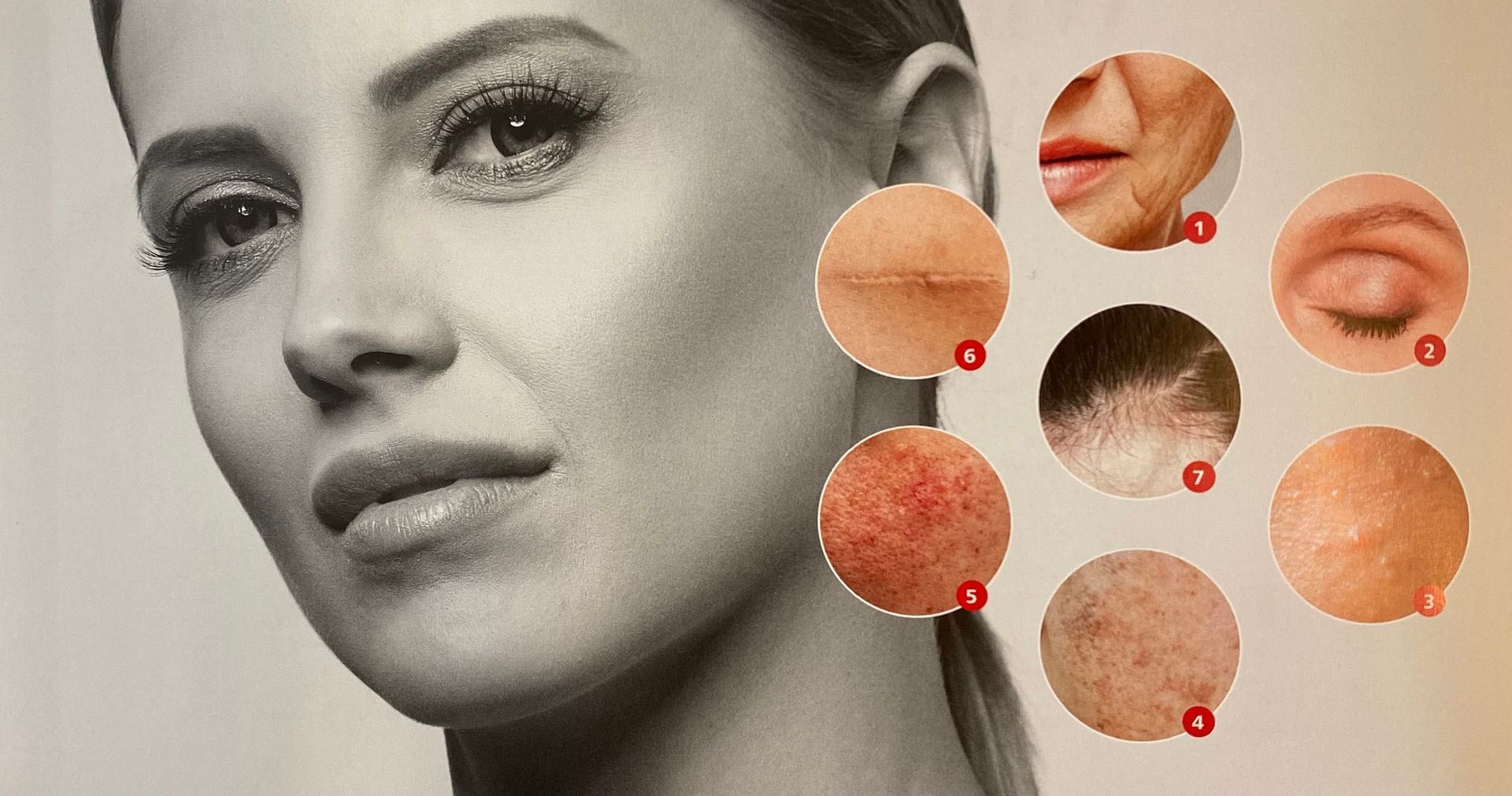 Permanent Make-up + Microneedling