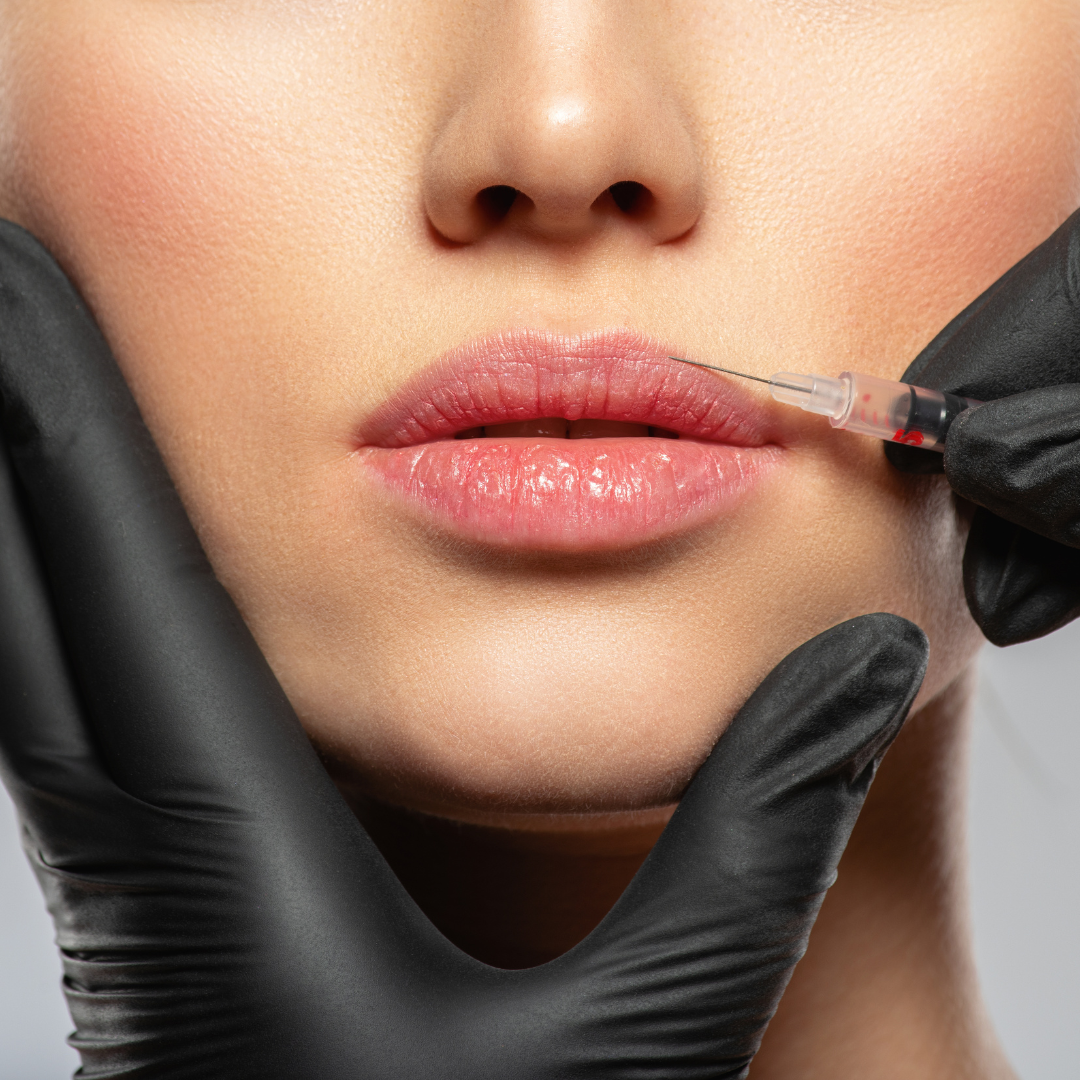 Eine Frau bekommt eine Botox-Injektion in die Lippen.