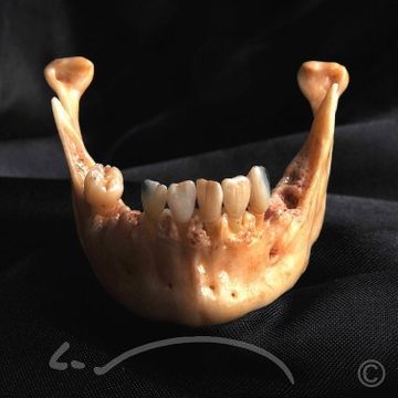 Laboratoire dentaire Enzo Di Stefano Sàrl | La Tour-de-Peilz