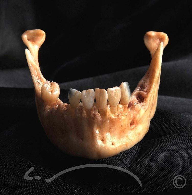 Laboratoire dentaire Enzo Di Stefano Sàrl | La Tour-de-Peilz