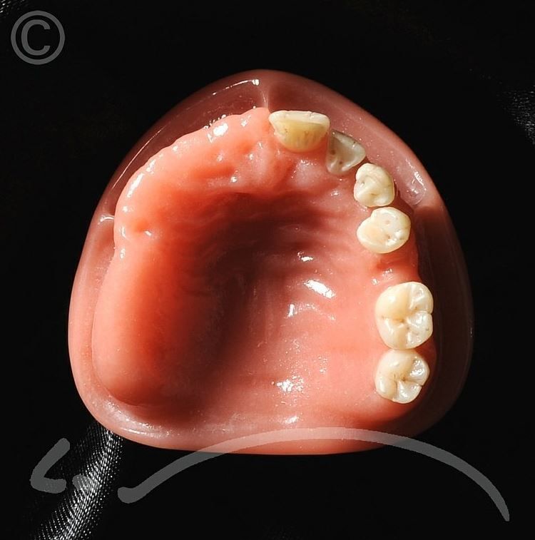 Laboratoire dentaire Enzo Di Stefano Sàrl | La Tour-de-Peilz
