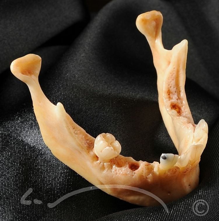 Laboratoire dentaire Enzo Di Stefano Sàrl | La Tour-de-Peilz