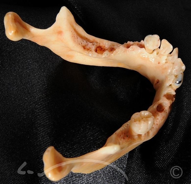 Laboratoire dentaire Enzo Di Stefano Sàrl | La Tour-de-Peilz