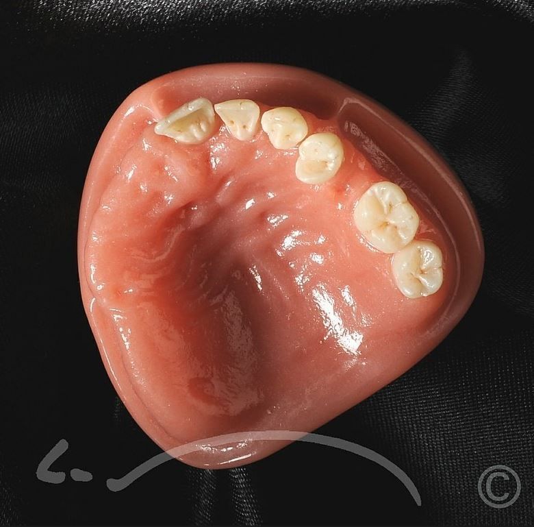 Laboratoire dentaire Enzo Di Stefano Sàrl | La Tour-de-Peilz