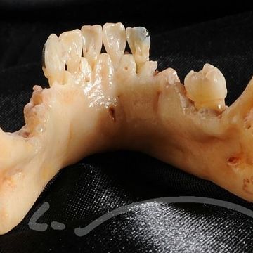 Laboratoire dentaire Enzo Di Stefano Sàrl | La Tour-de-Peilz