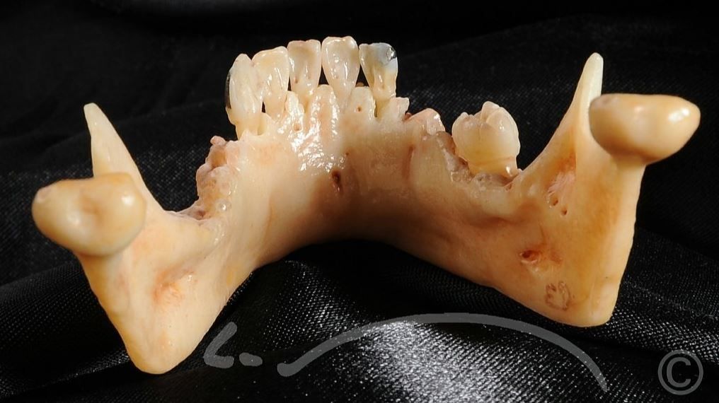 Laboratoire dentaire Enzo Di Stefano Sàrl | La Tour-de-Peilz