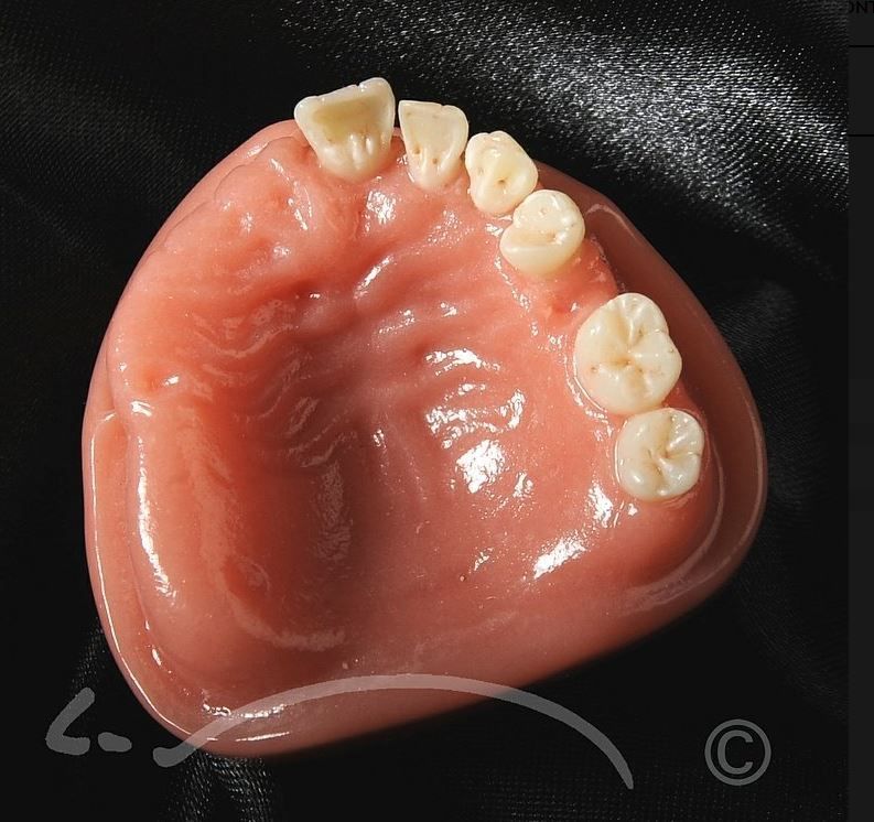 Laboratoire dentaire Enzo Di Stefano Sàrl | La Tour-de-Peilz