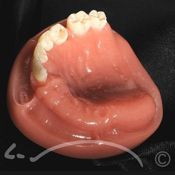 Laboratoire dentaire Enzo Di Stefano Sàrl | La Tour-de-Peilz