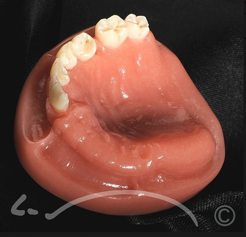 Laboratoire dentaire Enzo Di Stefano Sàrl | La Tour-de-Peilz