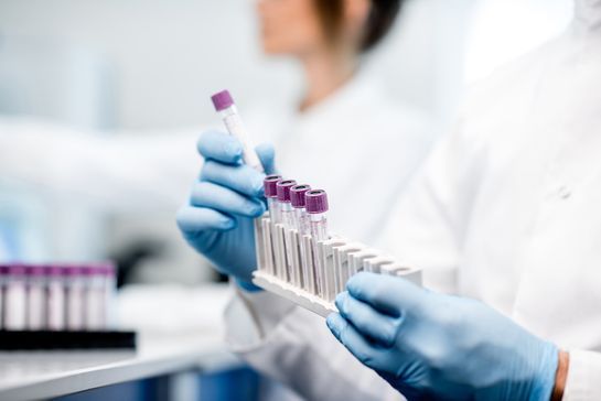 Person hält kleine Fläschchen für Laborproben in den Händen mit Gummihandschuhen