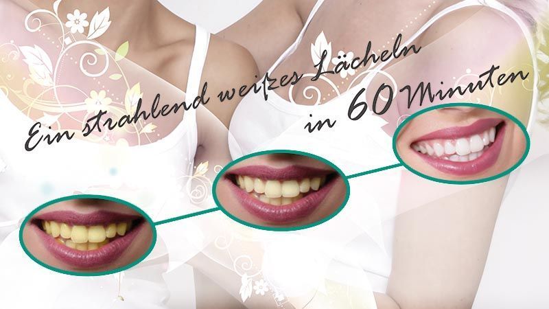 SDS Zahnästhetik GmbH