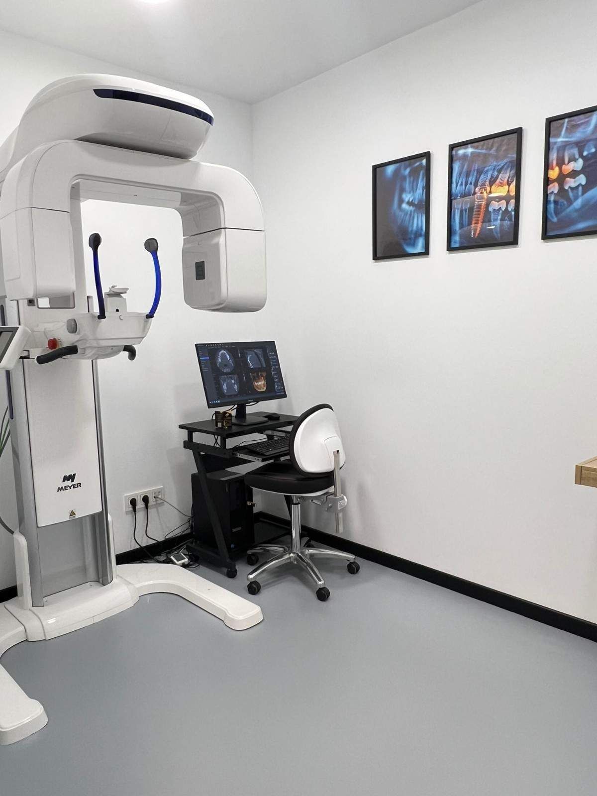 En una habitación luminosa y moderna, un aparato de rayos X panorámicos dentales se encuentra junto a una estación de trabajo