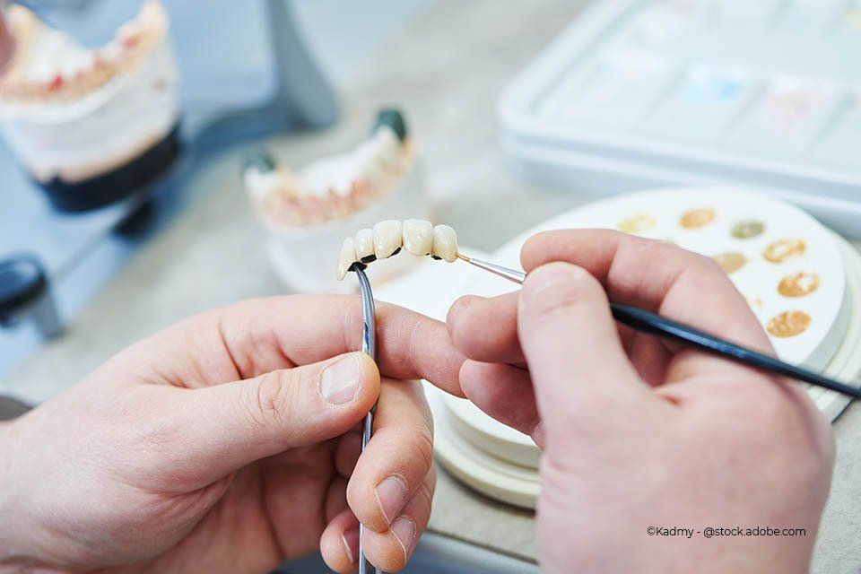 Mitarbeiter von Rink Berthold Zahnarztpraxis arbeitet an Zahnersatz