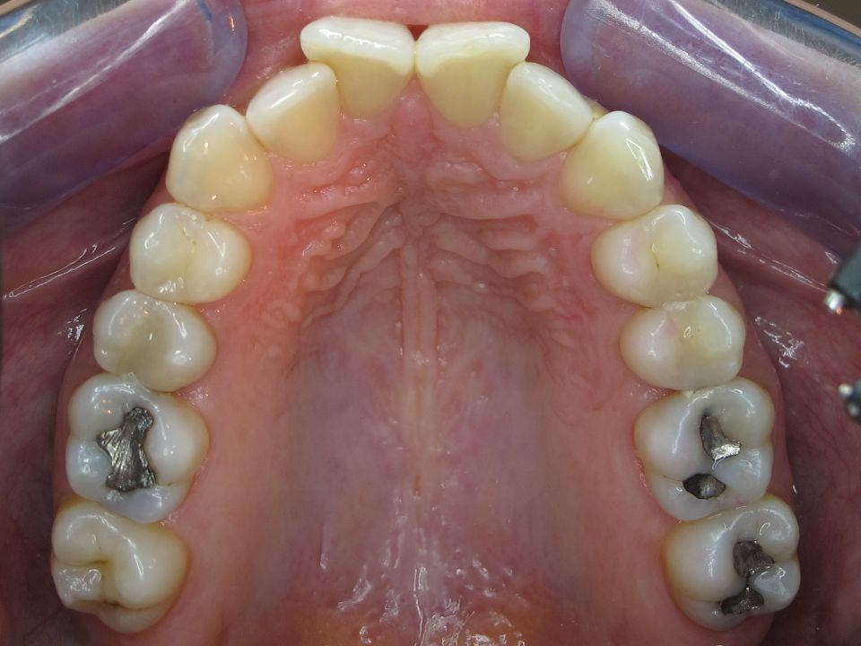 apdental ag