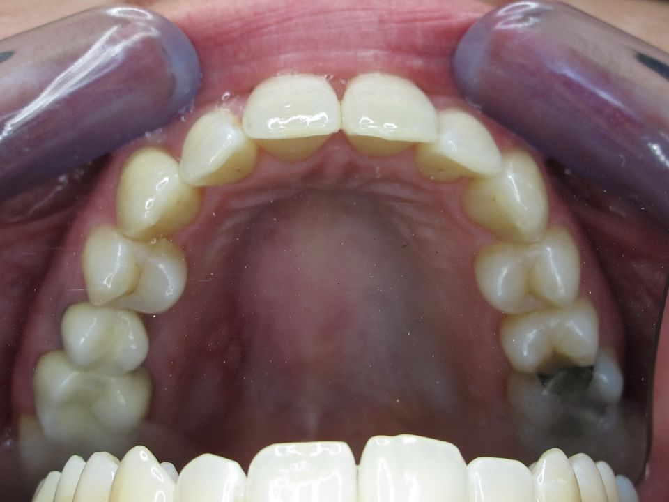 apdental ag