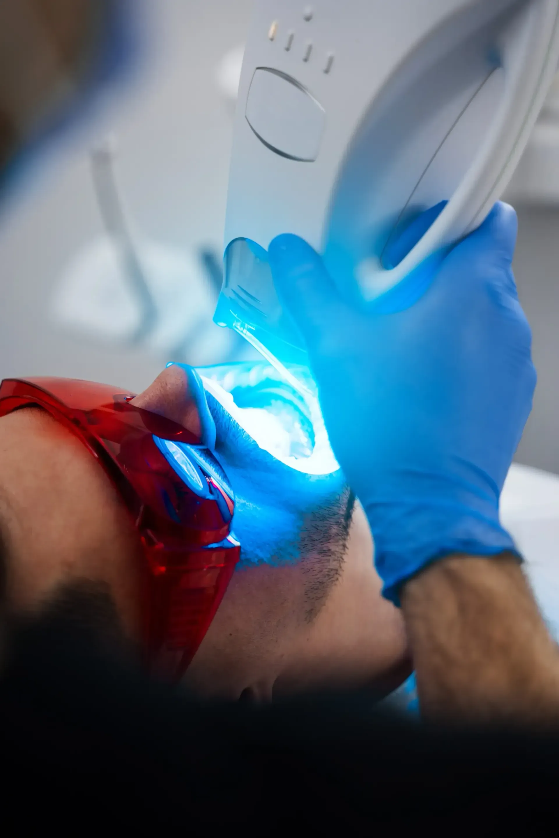 Dentista usando una lámpara de fotopolimerización portátil en la boca abierta de un paciente, brillo azul brillante