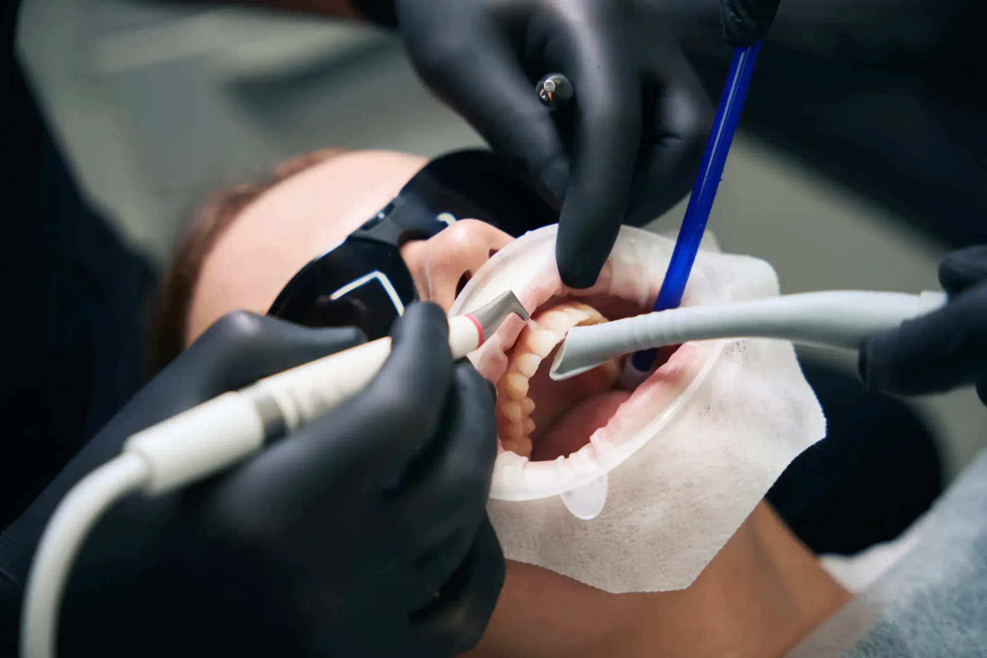Dentista limpiando los dientes de un paciente con instrumentos mientras el paciente usa gafas protectoras y un babero.