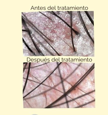 Icono de marcador de posición gris claro con un sol y montañas sobre fondo blanco