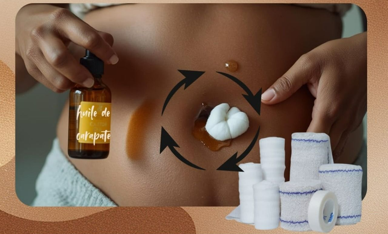 Une personne applique de l'huile à l'aide d'un compte-gouttes sur un nombril, avec des compresses et des pansements à proximité.