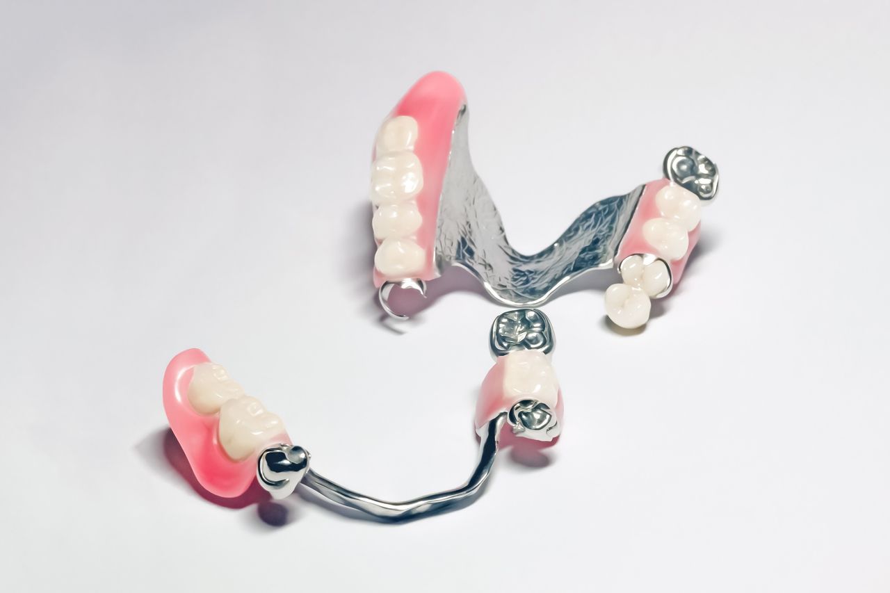 Un primer plano de una dentadura postiza sobre una superficie blanca.