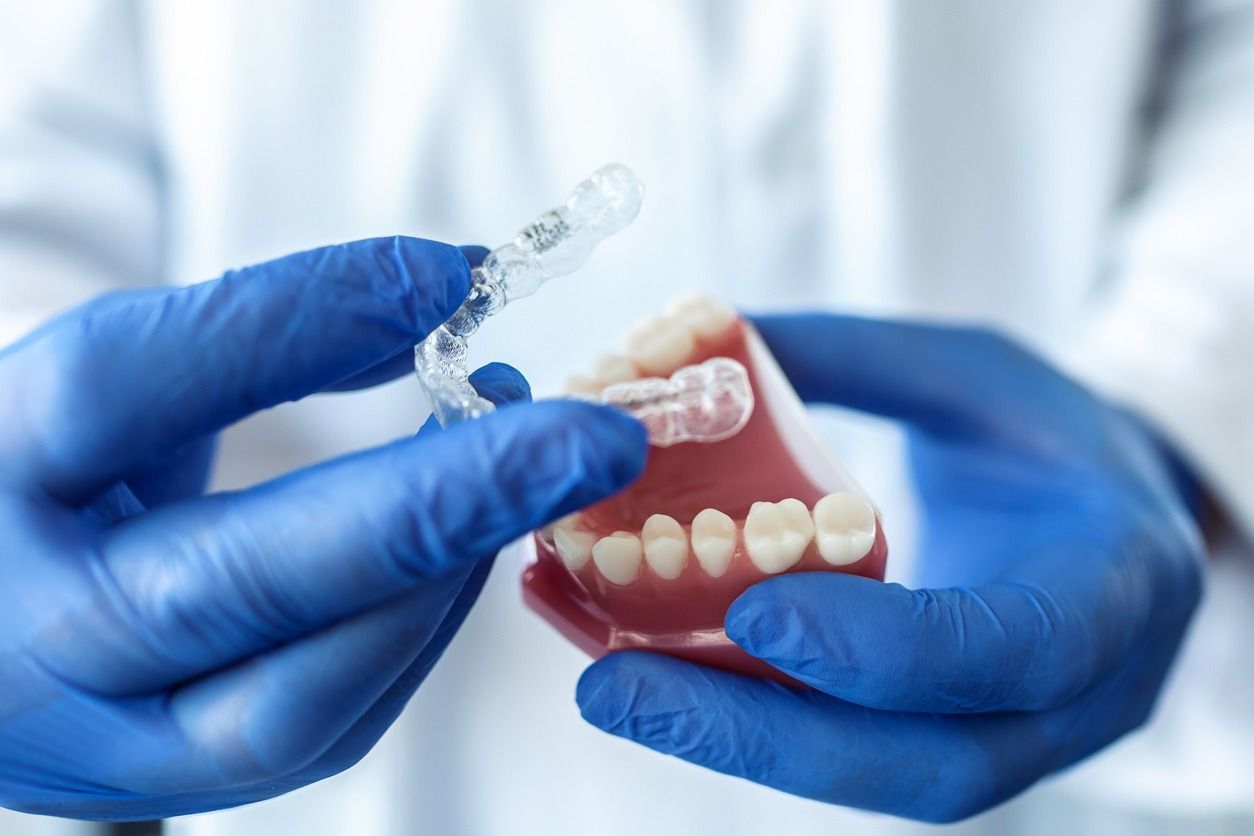 Un dentista sostiene un retenedor transparente sobre un modelo de dientes.