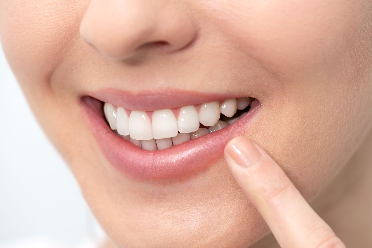 Una mujer se señala los dientes con el dedo.