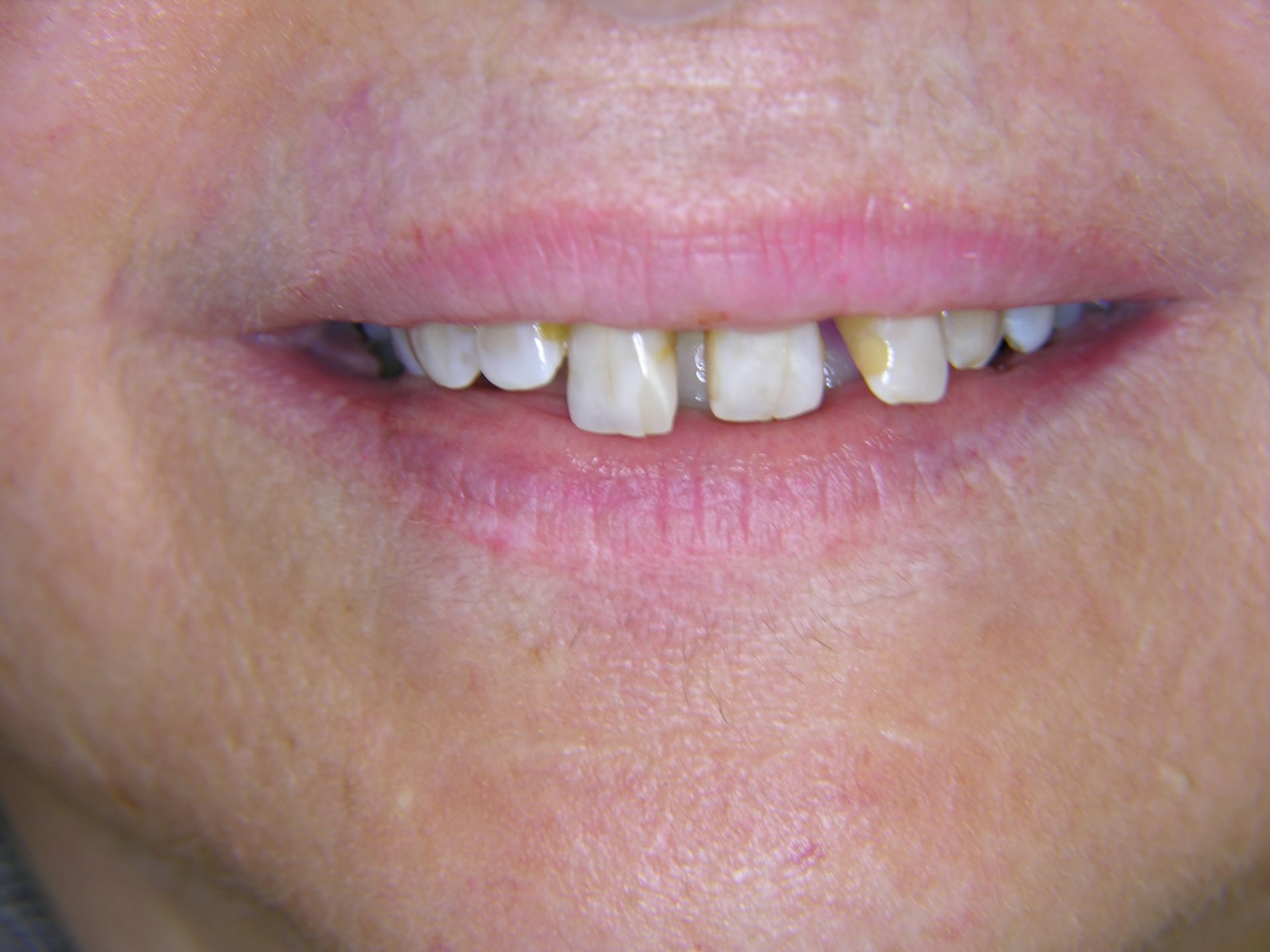 FALL 3 ANFANG BEHANDLUNG