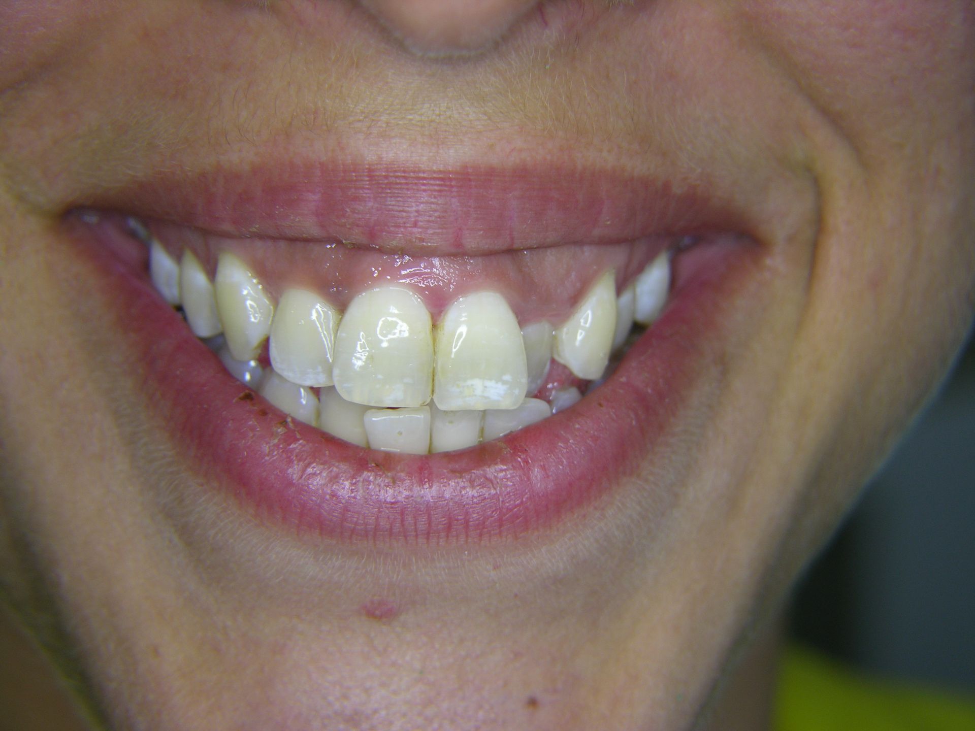 FALL 2  ANFANG BEHANDLUNG