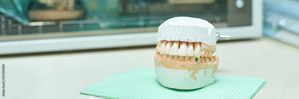 Un piccolo dessert a strati con glassa bianca su una tovaglietta verde menta in una cucina luminosa.