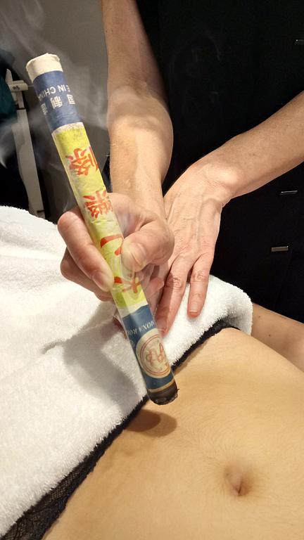 Moxibution directe par bâton d'armoise