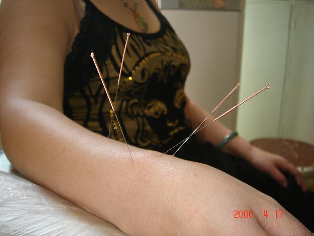 Traitement par aiguilles