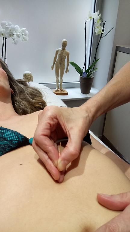 Implantation d'aiguille