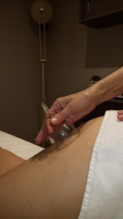 Traitement par ventouse tradtionnelle chinoise